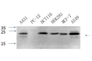 Western Blotting (WB) image for anti-Caveolin 1, Caveolae Protein, 22kDa (CAV1) antibody (ABIN5960477) (Caveolin-1 antibody)