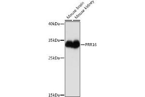 Western blot analysis of extracts of various cell lines, using PRR16 Rabbit pAb (ABIN7269554) at 1:1000 dilution. (PRR16 antibody  (AA 50-150))