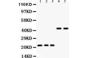 Anti- GPX1 antibody, Western blotting All lanes: Anti GPX1  at 0. (Glutathione Peroxidase 1 antibody  (Middle Region))
