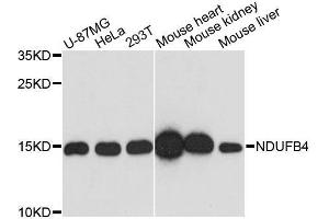 Western blot analysis of extracts of various cell lines, using NDUFB4 antibody. (NDUFB4 antibody  (AA 1-90))