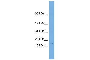 WB Suggested Anti-FHIT Antibody Titration:  0. (FHIT antibody  (Middle Region))