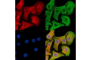 ABIN7094960 and ABIN7099016 staining Hela cells by IF/ICC.