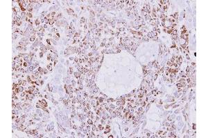 IHC-P Image Immunohistochemical analysis of paraffin-embedded A549 xenograft, using Creatine kinase 1B, antibody at 1:300 dilution. (CKMT1B antibody)