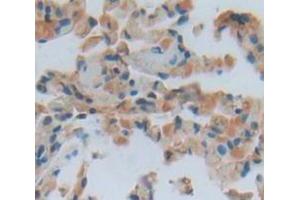 IHC-P analysis of Human Tissue, with DAB staining. (Vitronectin antibody  (AA 19-111))