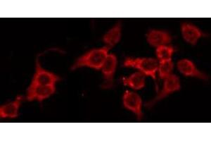 ABIN6268739 staining HeLa by IF/ICC. (Cathepsin D antibody  (C-Term))
