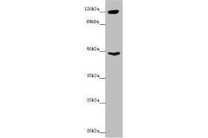Western blot All lanes: INPP4A antibody at 8.
