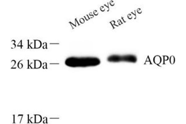 MIP antibody