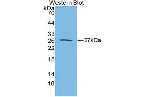 Western Blotting (WB) image for anti-Aggrecan (ACAN) (AA 2162-2316) antibody (ABIN2117831) (Aggrecan antibody  (AA 2162-2316))