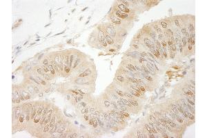 Immunohistochemistry (IHC) image for anti-RAN Binding Protein 1 (RANBP1) (AA 1-50) antibody (ABIN7449008) (RANBP1 antibody  (AA 1-50))
