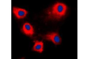 Immunofluorescent analysis of ARFIP1 staining in HeLa cells. (ARFIP1 antibody  (C-Term))