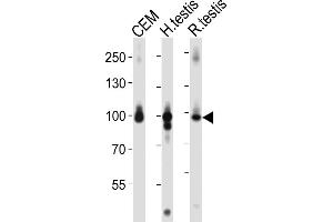 Western blot analysis of lysates from CEM cell line, human testis, rat testis tissue lysate (from left to right), using AC Antibody (C-term) 1151a. (Centaurin beta 2 antibody  (C-Term))