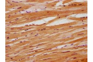IHC image of ABIN7160584 diluted at 1:100 and staining in paraffin-embedded human heart tissue performed on a Leica BondTM system.