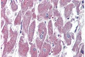 Human Heart (formalin-fixed, paraffin-embedded) stained with GPR116 antibody ABIN399995 at 10 ug/ml followed by biotinylated goat anti-rabbit IgG secondary antibody ABIN481713, alkaline phosphatase-streptavidin and chromogen. (G Protein-Coupled Receptor 116 antibody  (Internal Region))