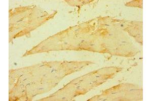 Immunohistochemistry of paraffin-embedded human skeletal muscle tissue using ABIN7158678 at dilution of 1:100 (BRCC3 antibody  (AA 1-316))