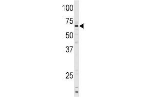 Western Blotting (WB) image for anti-Cytochrome P450, Family 1, Subfamily A, Polypeptide 1 (CYP1A1) antibody (ABIN2897823) (CYP1A1 antibody)
