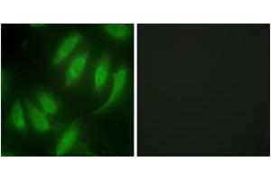 Immunofluorescence analysis of HeLa cells, using HEXIM1 Antibody. (HEXIM1 antibody  (AA 181-230))