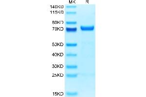 Human MMP-2 on Tris-Bis PAGE under reduced condition. (MMP2 Protein (AA 34-660) (His tag))