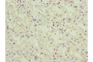 Immunohistochemistry (IHC) image for anti-Ring Finger Protein 5, E3 Ubiquitin Protein Ligase (RNF5) (AA 1-120) antibody (ABIN7151202)