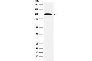 Western blot analysis of AP1G1 expression in 293T cell lysate. (Recombinant gamma 1 Adaptin antibody)