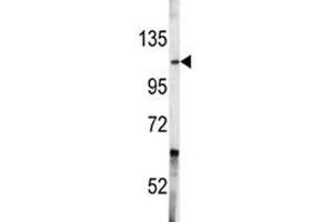 Western Blotting (WB) image for anti-C-Abl Oncogene 1, Non-Receptor tyrosine Kinase (ABL1) (AA 741-769) antibody (ABIN3028519)