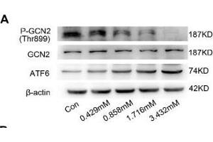 BCAA increase PPAR-α expression in a GCN2/ATF6 pathway-dependent manner.
