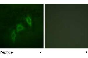 Immunofluorescence analysis of HepG2 cells, using TSC2 polyclonal antibody . (Tuberin antibody)