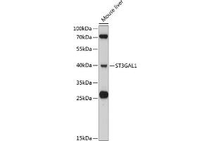 Western blot analysis of extracts of mouse liver, using ST3G antibody (ABIN6130190, ABIN6148520, ABIN6148522 and ABIN6215305) at 1:3000 dilution. (ST3GAL1 antibody  (AA 35-135))