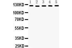 Western Blotting (WB) image for anti-Damage Specific DNA Binding Protein 1 (DDB1) (AA 1011-1140) antibody (ABIN3043823) (DDB1 antibody  (AA 1011-1140))