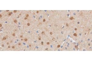 Immunohistochemistry of paraffin-embedded Mouse brain using MAP2K6 Polyclonal Antibody at dilution of 1:50 (MAP2K6 antibody)