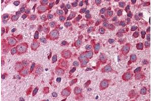 Mouse Brain: Formalin-Fixed, Paraffin-Embedded (FFPE) (FBXW7 antibody  (AA 251-300))