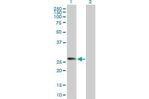 Western Blot analysis of RABL2B expression in transfected 293T cell line by RABL2B MaxPab polyclonal antibody. (RABL2B antibody  (AA 1-229))
