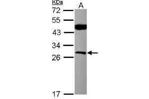 WB Image Sample (30 ug of whole cell lysate) A: MCF-7 12% SDS PAGE antibody diluted at 1:500 (CSNK2B antibody)