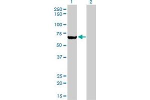 Western Blot analysis of MTMR2 expression in transfected 293T cell line by MTMR2 monoclonal antibody (M03), clone 4G6. (MTMR2 antibody  (AA 5-100))