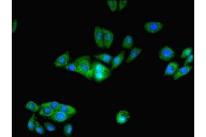 Immunofluorescent analysis of HepG2 cells using ABIN7164206 at dilution of 1:100 and Alexa Fluor 488-congugated AffiniPure Goat Anti-Rabbit IgG(H+L) (PFDN1 antibody  (AA 2-122))