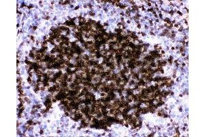 IHC-P: CD23 antibody testing of mouse spleen tissue (FCER2 antibody  (AA 50-331))