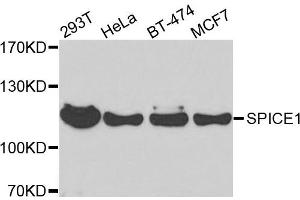 Western blot analysis of extracts of various cells, using SPICE1 antibody. (SPICE1 antibody)