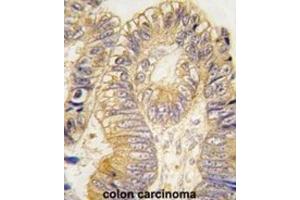 Immunohistochemistry (IHC) image for anti-Chloride Intracellular Channel 5 (CLIC5) antibody (ABIN3003306) (CLIC5 antibody)