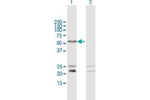 Western Blot analysis of C1orf103 expression in transfected 293T cell line by C1orf103 MaxPab polyclonal antibody.