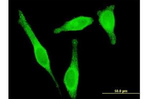 Immunofluorescence of monoclonal antibody to STAU1 on HeLa cell. (STAU1/Staufen antibody  (AA 401-496))