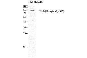 Western Blotting (WB) image for anti-Neurotrophic Tyrosine Kinase, Receptor, Type 2 (NTRK2) (pTyr516) antibody (ABIN3182168) (TRKB antibody  (pTyr516))