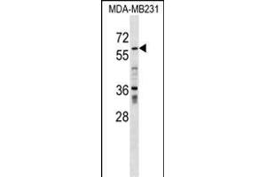 ZN Antibody (N-term) (ABIN1539343 and ABIN2849295) western blot analysis in MDA-M cell line lysates (35 μg/lane). (ZNF543 antibody  (N-Term))