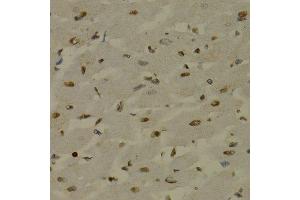 Immunohistochemistry (Paraffin-embedded Sections) (IHC (p)) image for anti-Nuclear Factor of kappa Light Polypeptide Gene Enhancer in B-Cells 2 (NFKB2) (AA 690-899) antibody (ABIN3017388)