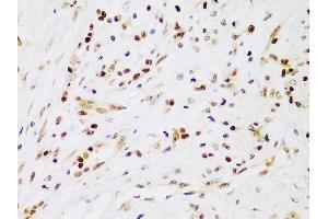 Immunohistochemistry (IHC) image for anti-Inhibitor of kappa Light Polypeptide Gene Enhancer in B-Cells, Kinase beta (IKBKB) (AA 630-730) antibody (ABIN3022876)
