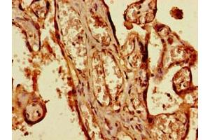 Immunohistochemistry of paraffin-embedded human placenta tissue using ABIN7169019 at dilution of 1:100 (BRSK1 antibody  (AA 426-591))