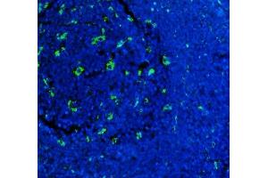 IF analysis of CD68 using anti-CD68 antibody (ABIN7600142). (CD68 antibody  (AA 154-354))