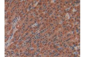 DAB staining on IHC-P; Samples: Rat Stomach Tissue (IL22RA2 antibody  (AA 30-228))