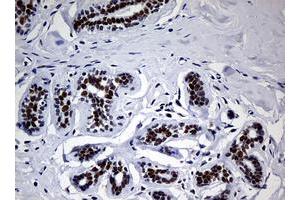 Image no. 2 for anti-Nibrin (NBN) (AA 183-460) antibody (ABIN1491059)