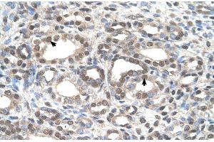 Human kidney (DFNA5 antibody  (C-Term))