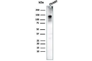 Western Blot Analysis of human Ovary tissue using Caldesmon Mouse Monoclonal Antibody (h-CALD). (Caldesmon antibody)