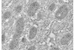 Immunoelectron microscopy analysis of LR white resin-embedded mouse liver using HSP60 (ABIN7074167) at dilution of 1: 50. (HSPD1 antibody)